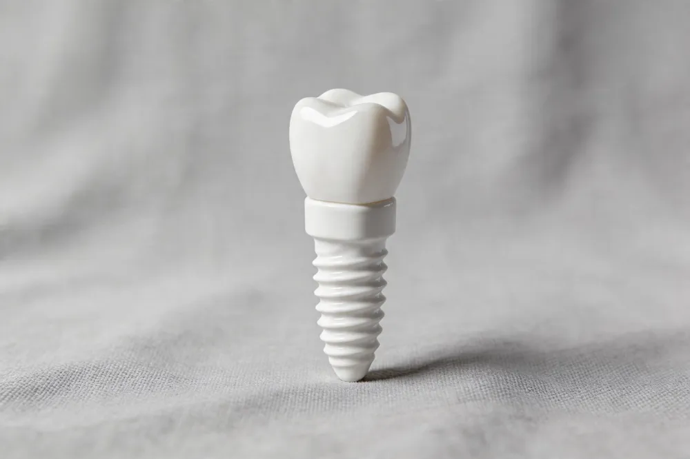 How a Periodontist Can Turn a Failing Implant into a Long‑Term Success